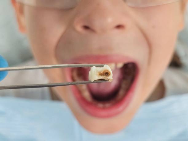 Best Emergency Orthodontic Repairs in Locust Grove, GA